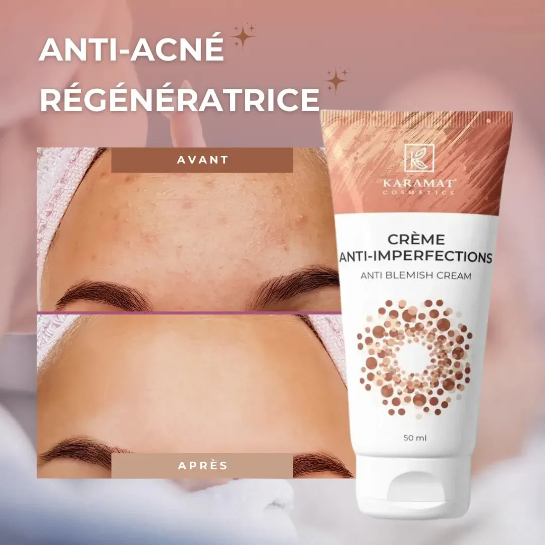 Crème Visage Anti-Imperfections 50 ml – Karamat - Afbeelding 3