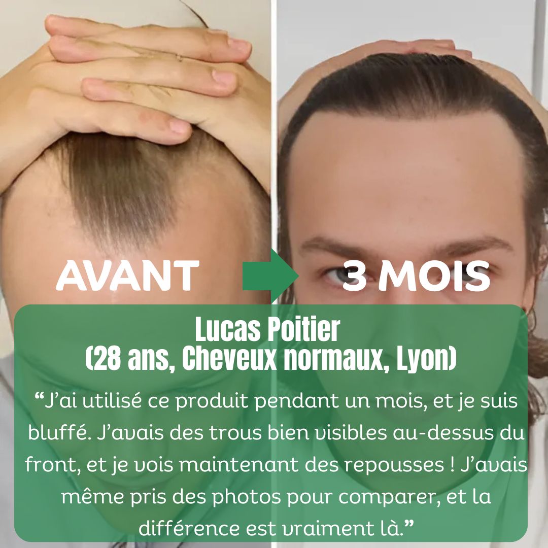 Sérum Capillaire Vivaci au Romarin, Avocat & Argan – Soin Fortifiant Naturel - Image 5