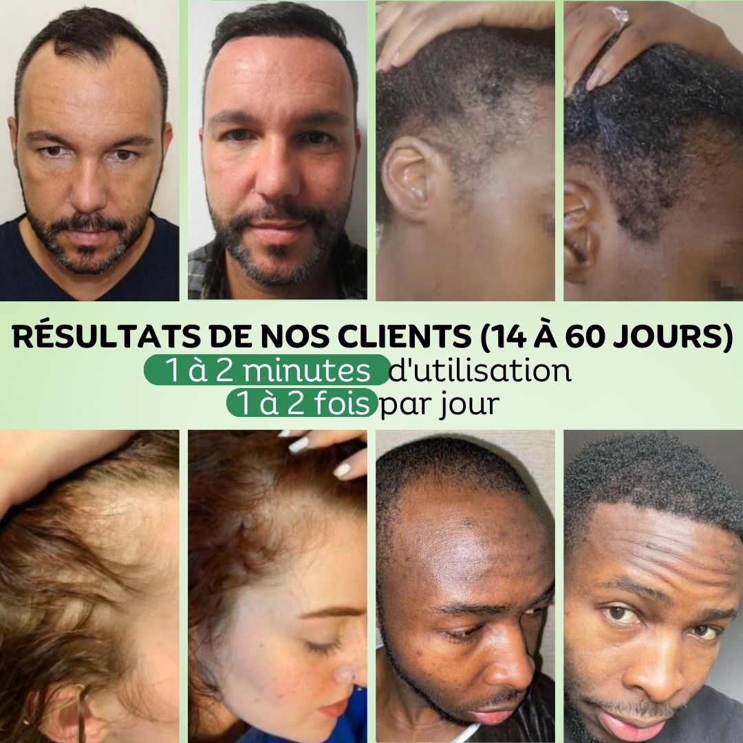 Sérum Capillaire Vivaci au Romarin, Avocat & Argan – Soin Fortifiant Naturel - Image 2